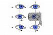Zakrývací zkouška u pravé esotropie (pohyb oka a zakrývací destičky je naznačen pomocí šipek): (a) uchýlené pravé oko dovnitř; (b) levé oko je zakryto – obě oči se pohybují směrem doprava; (c) zakryté levé oko se uchyluje dovnitř a odkryté pravé oko přebí