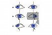 Zakrývací zkouška u pravé exotropie s pravou hypertropií: (a) pravé oko je uchýleno zevně a nahoru; (b) levé oko je zakryto – obě oči se pohybují směrem doleva a dolů, pravé oko přebírá fixaci a levé se uchyluje zevně a dolů (levá exotropie s levou hypotr